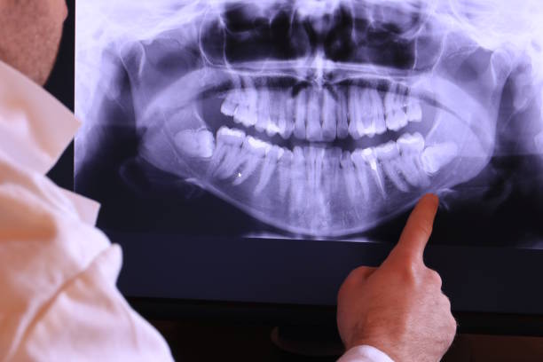 Best Emergency Treatment for Dental Infections or Abscesses in Vernon, TX