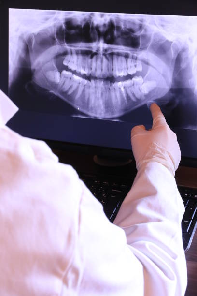 Best Emergency Treatment for Dental Infections or Abscesses in Vernon, TX