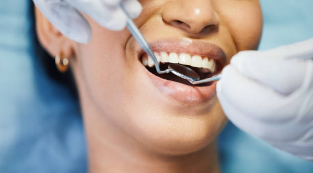 Best Emergency Dental Care for Broken or Chipped Teeth in Vernon, TX